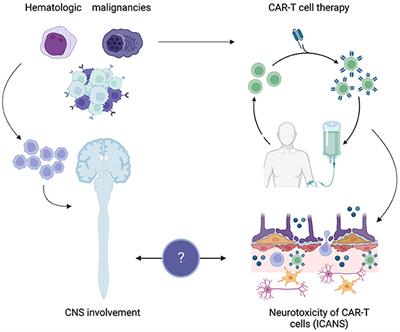 CAR T-cell-associated neurotoxicity in central nervous system hematologic disease: Is it still a concern?